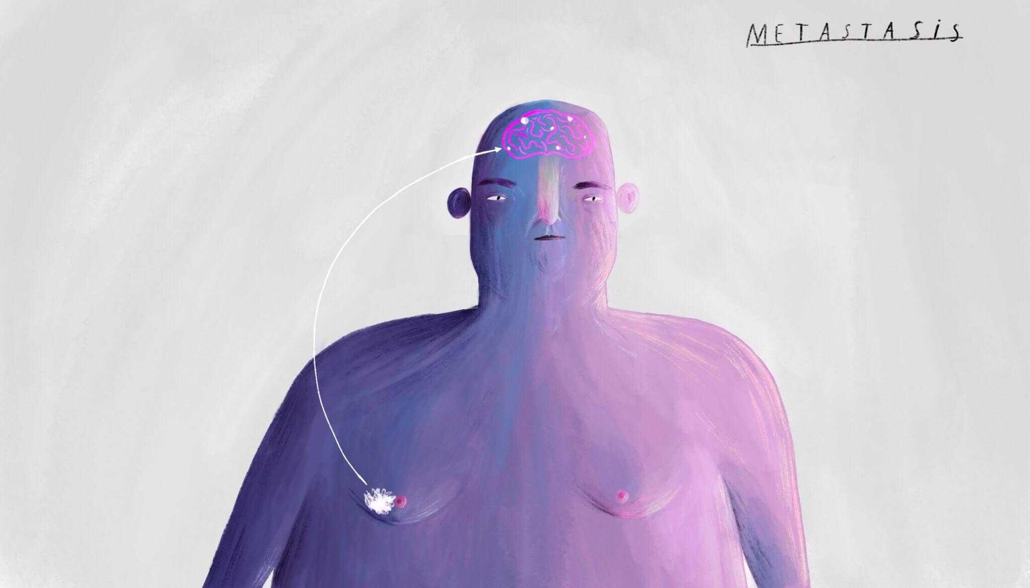 KOEF-brain-tumour-neurosurgeon-brisbane-2048×1170