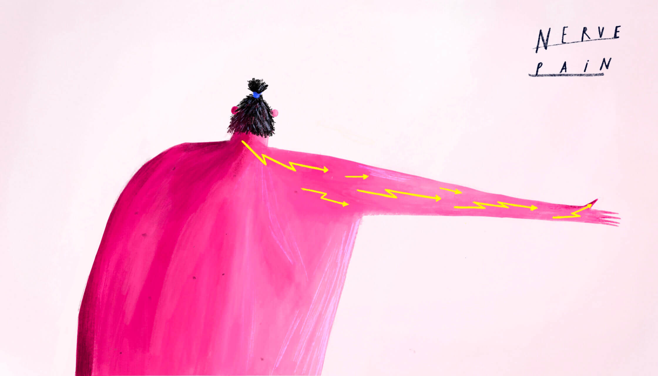 KOEF-nerve-pain-neurosurgeon-brisbane