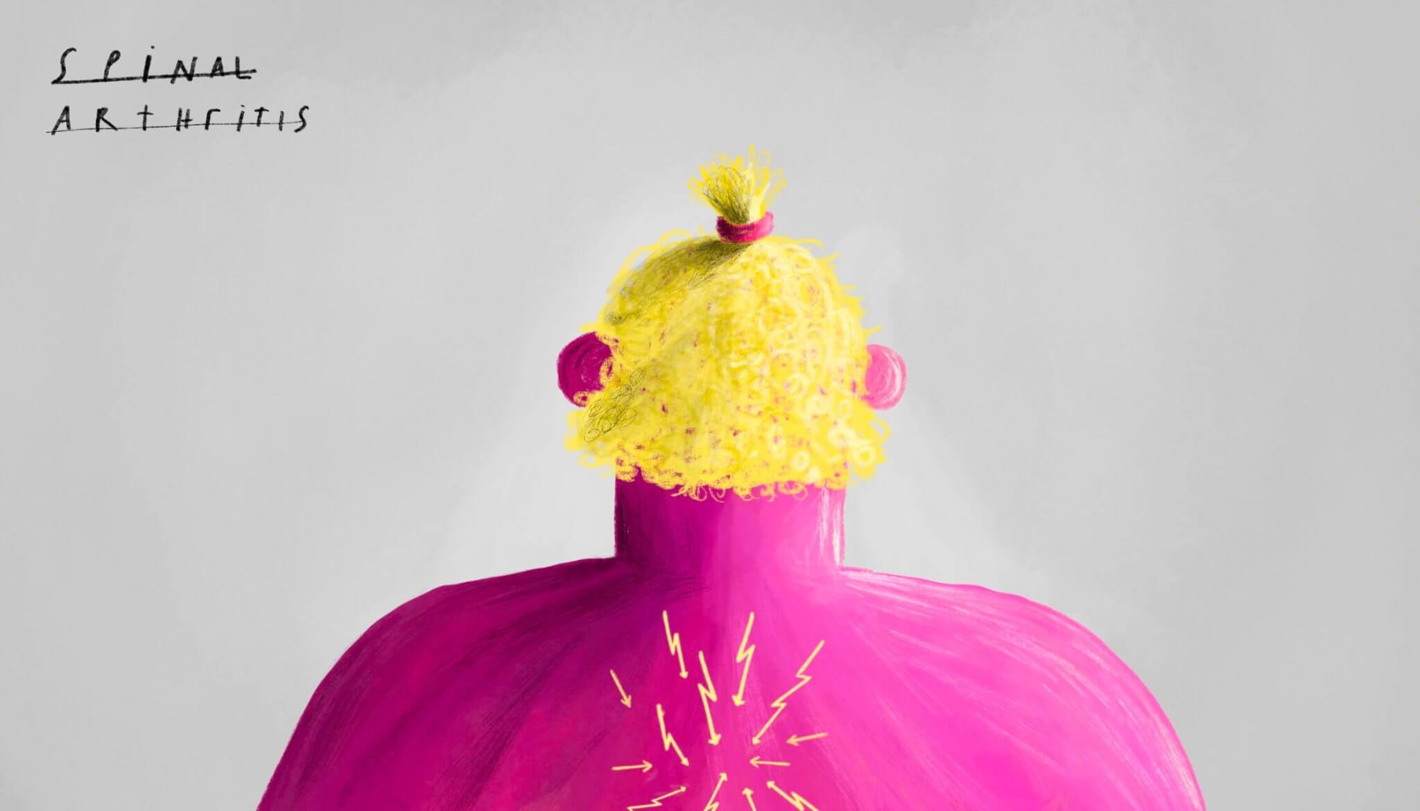 KOEF-spinal-arthritis-neurosurgeon-brisbane-2048×1170