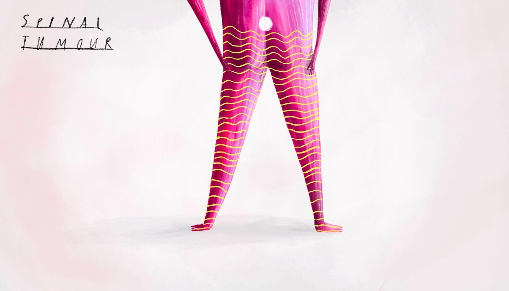 KOEF-spinal-tumours-neurosurgeon-brisbane-2048×1170