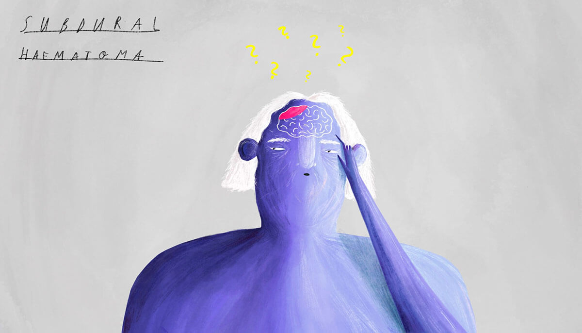 KOEF-subdural-haematoma-neurosurgeon-brisbane